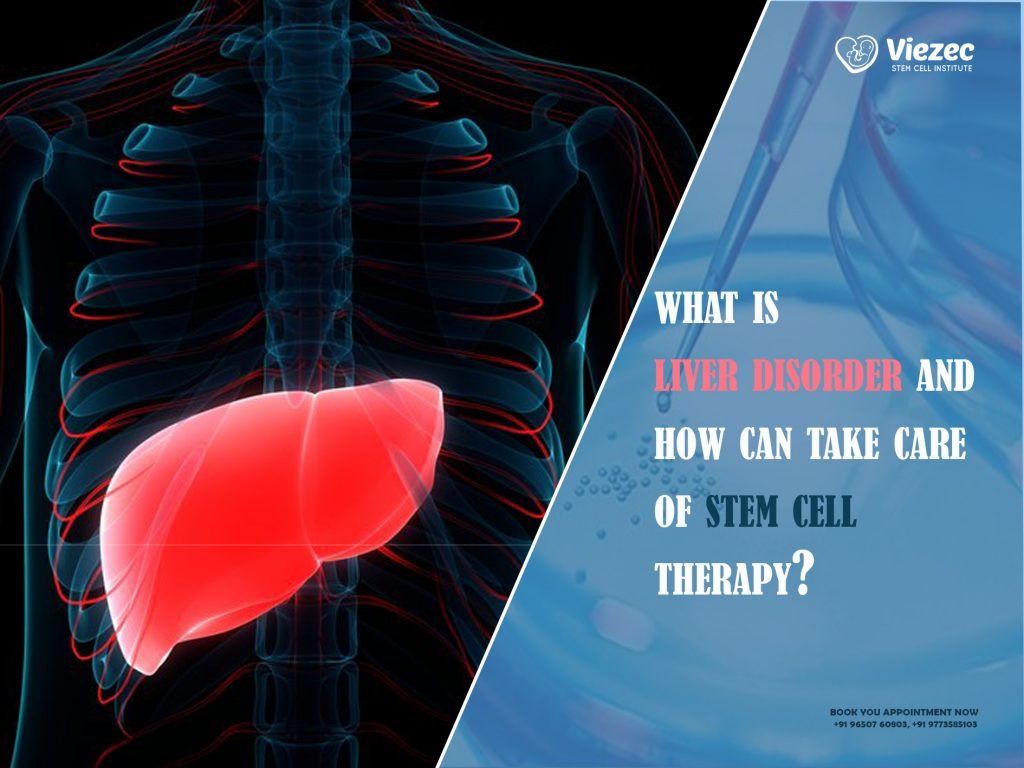 what is liver disorder and how can take care of stem cell therapy
