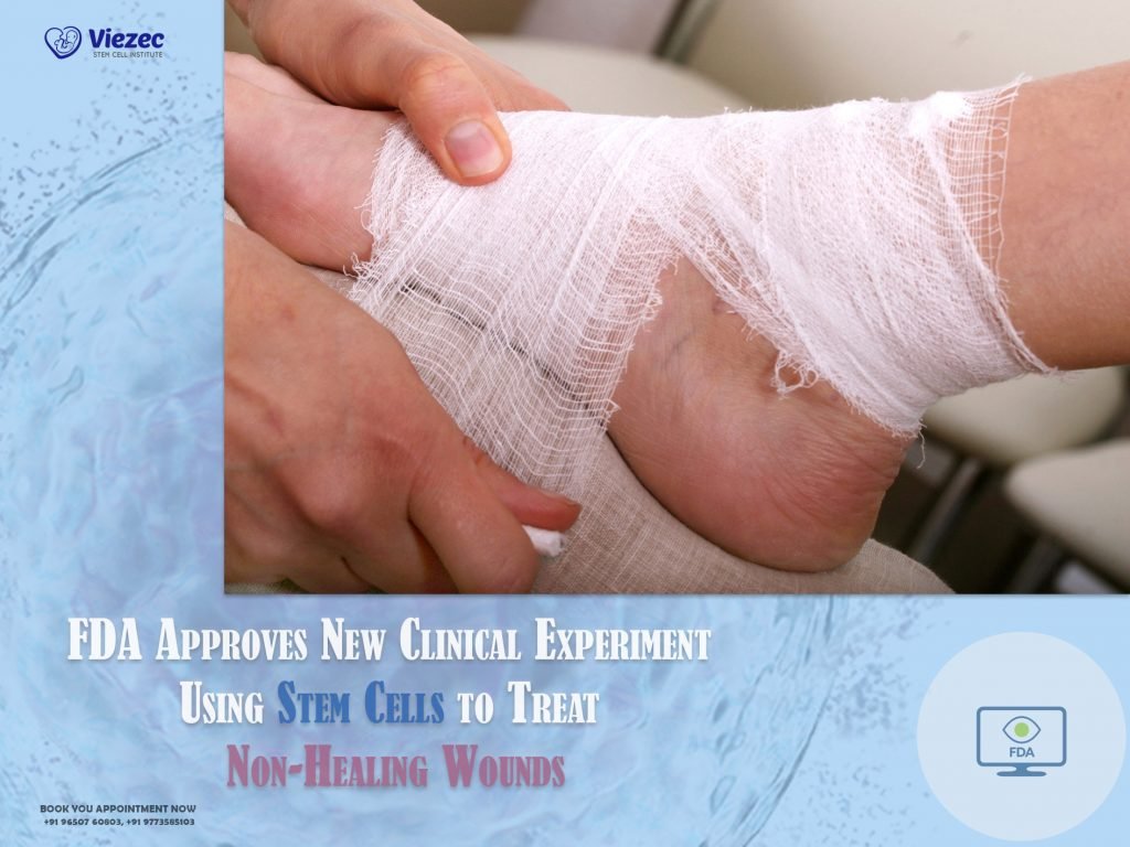 FDA Approves New Clinical Experiment Using Stem Cells to Treat Non-Healing Wounds (1)