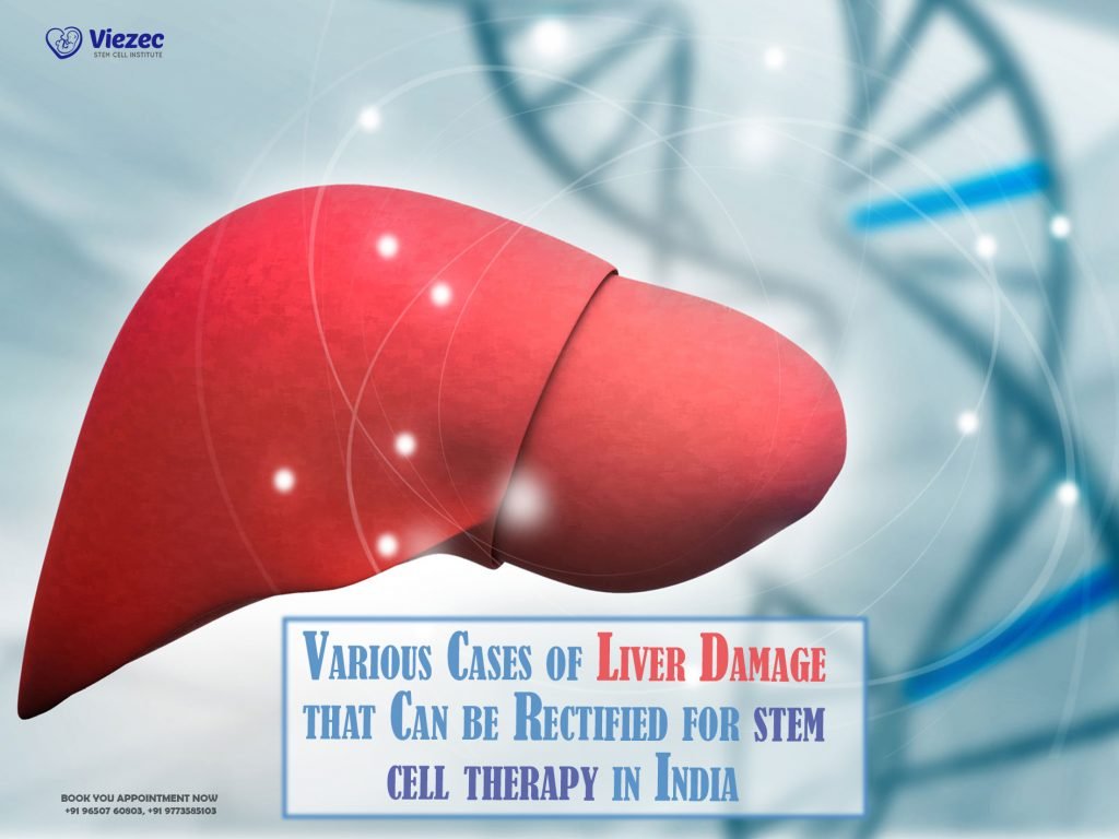 Various Cases of Liver Damage that Can be Rectified for stem cell therapy in India