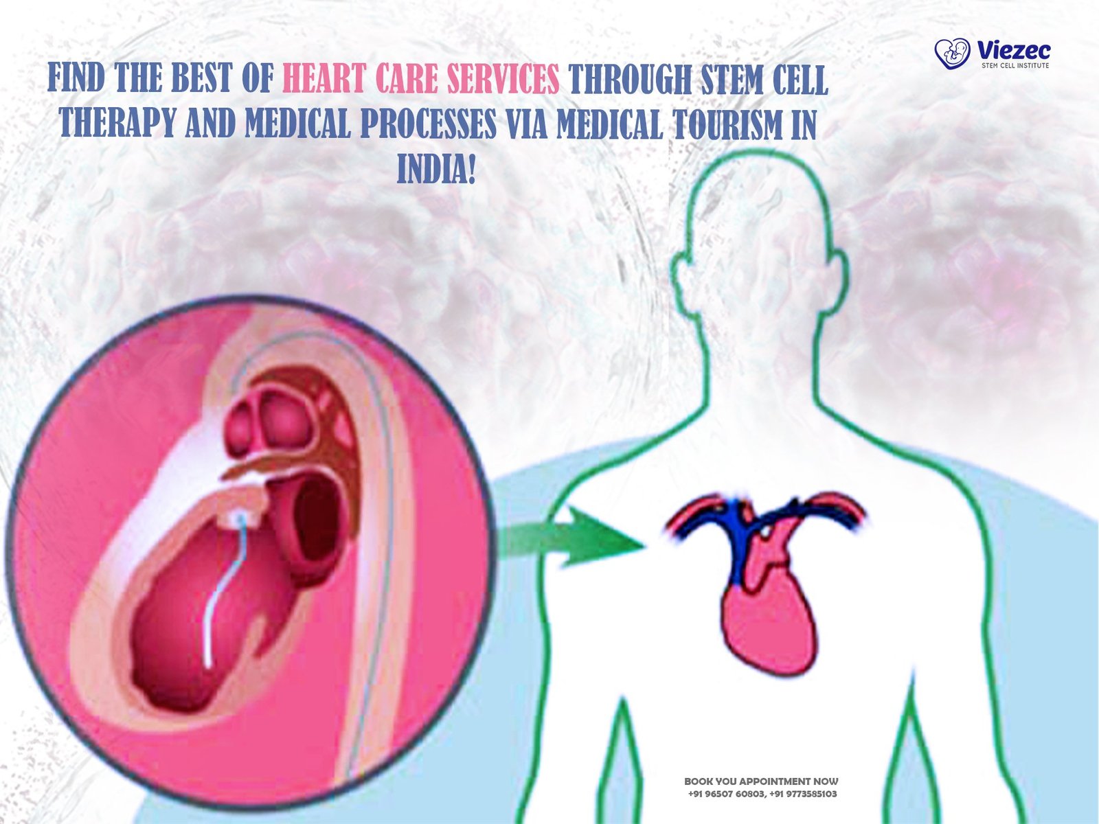 Find the Best of Heart Care Services through stem cell therapy and Medical Processes via Medical Tourism in India!