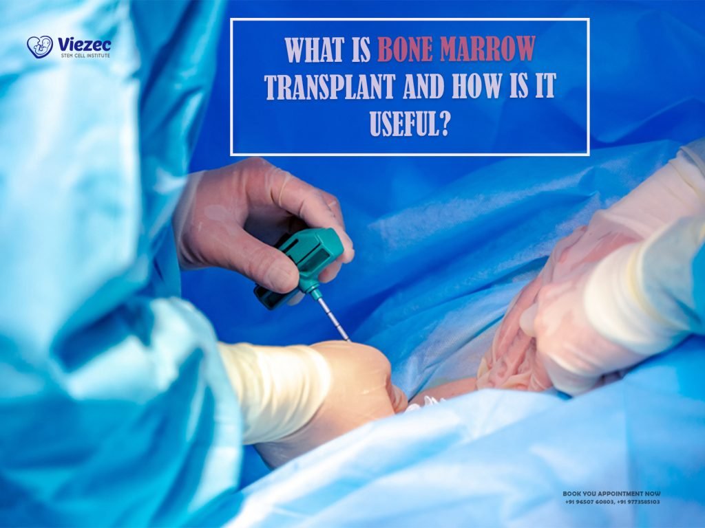 What Is Bone Marrow Transplant And How Is It Useful