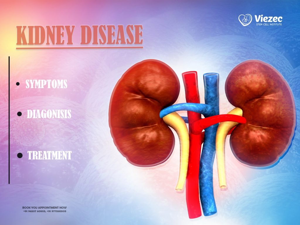Kidney Cancer Symptoms, Diagnosis, And Treatment