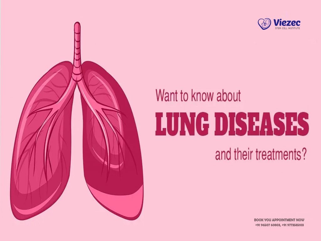 Health Tourism For Lungs Organ Transplant In India