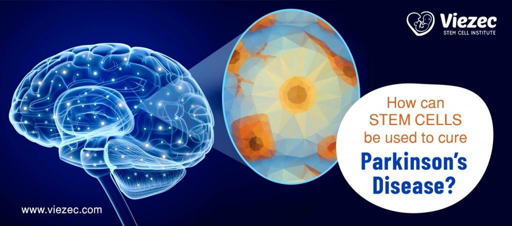 Parkinson’s-disease