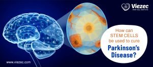 Parkinson’s-disease