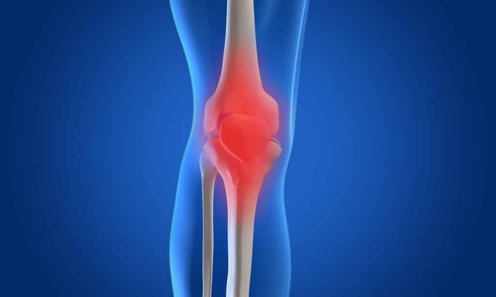 Osteoarthritis