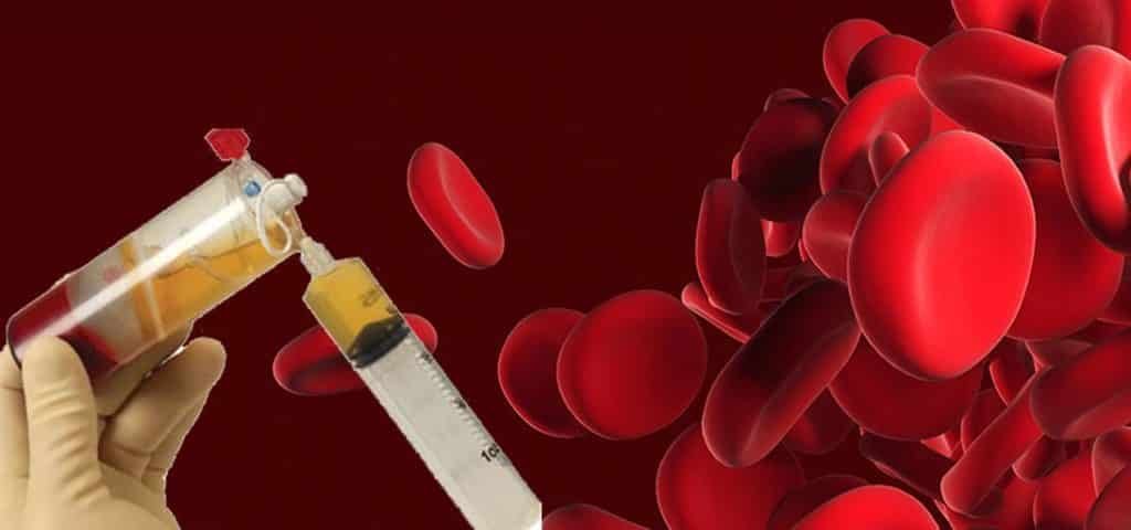 Platelet Rich Plasma