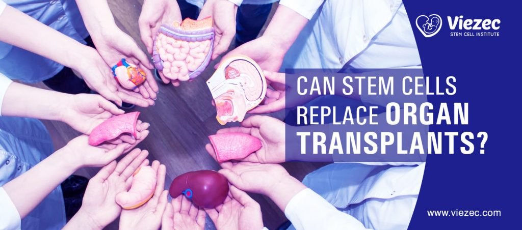 Can Stem Cells Replace Organ Transplants?