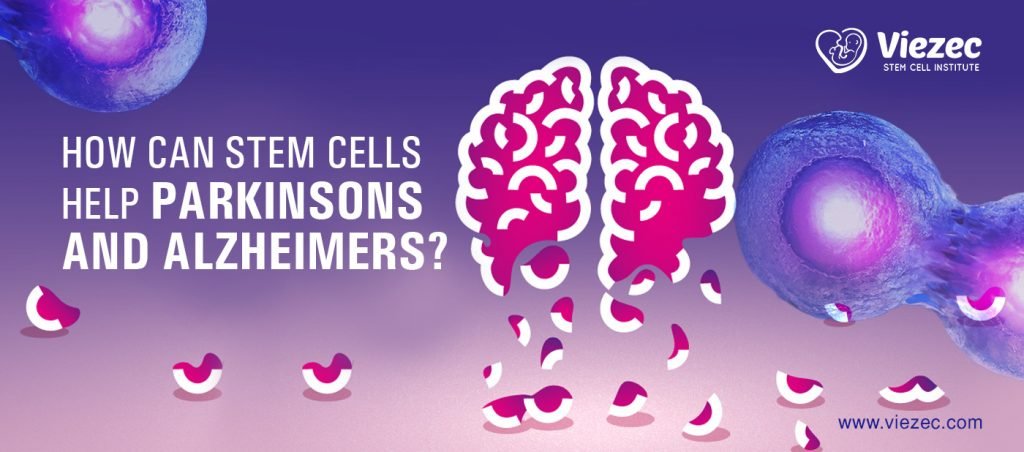 How Can Stem Cells Help Parkinson’s And Alzheimer’s