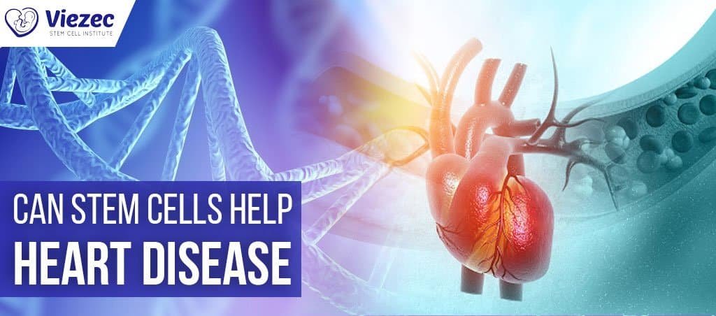 Can Stem Cells Help Heart Disease