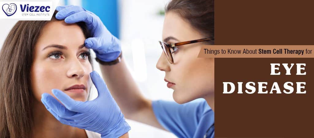 Stem Cell Therapy for Eye