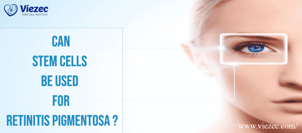 Can stem cells be used for Retinitis Pigmentosa_-Can stem cells be used for Retinitis Pigmentosa