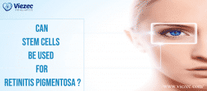 Can stem cells be used for Retinitis Pigmentosa_-Can stem cells be used for Retinitis Pigmentosa