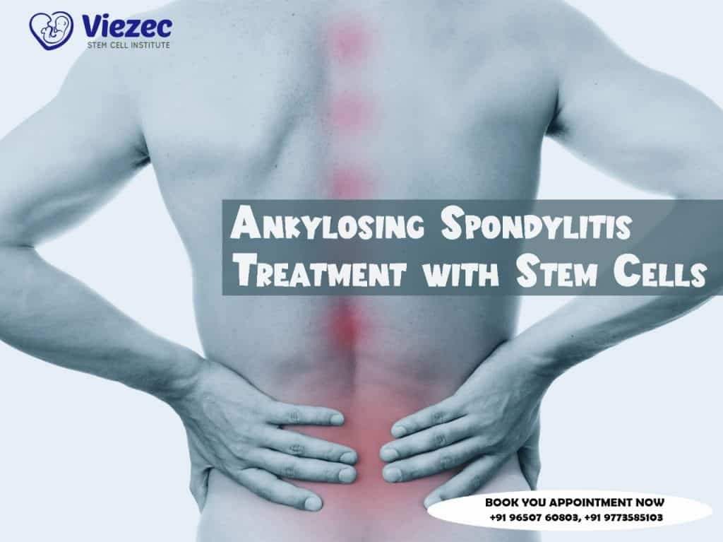Ankylosing Spondylitis Treatment