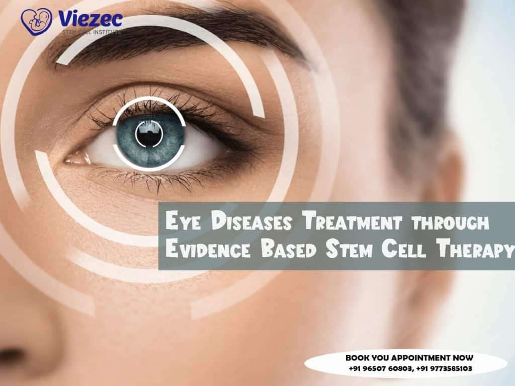 Eye Diseases Treatment