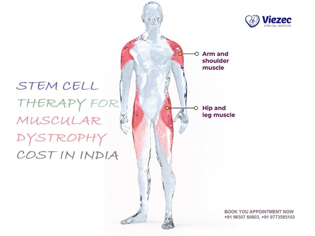 Stem Cell Treatment for Muscular Dystrophy Cost in India