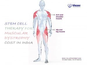 Stem Cell Treatment for Muscular Dystrophy Cost in India