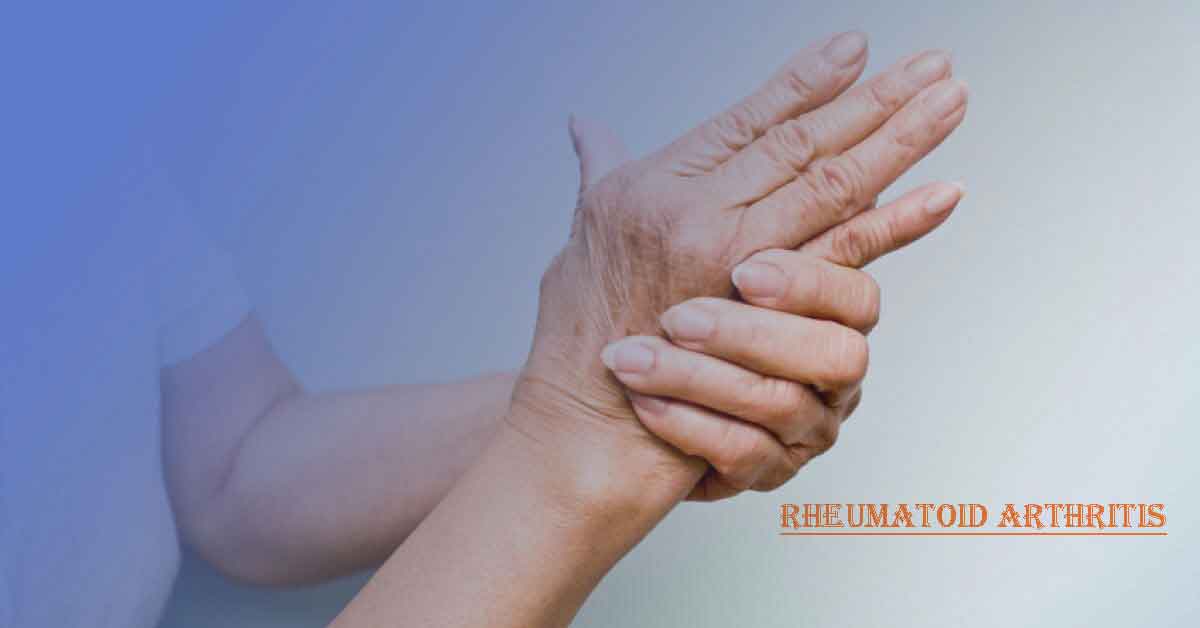 Stem Cell Treatment for Rheumatoid Arthritis in Delhi, India