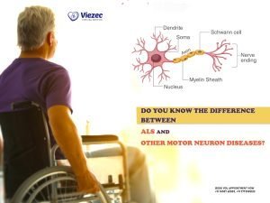 difference between aLS and other motor neuron diseases