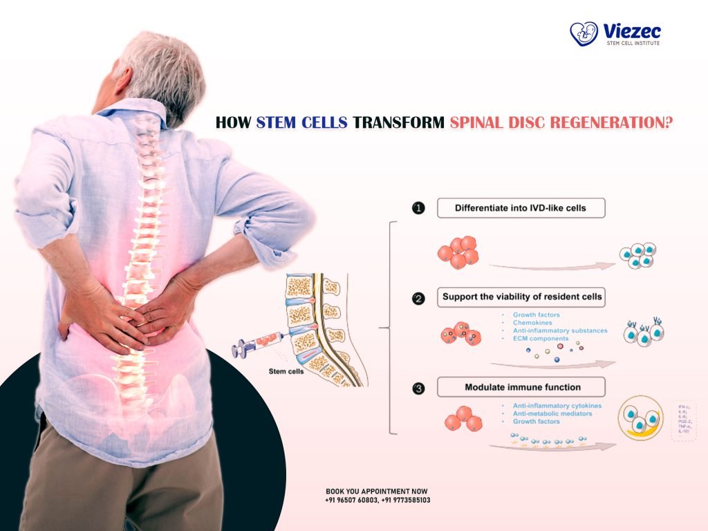 How Stem Cells Transform Spinal Disc Regeneration