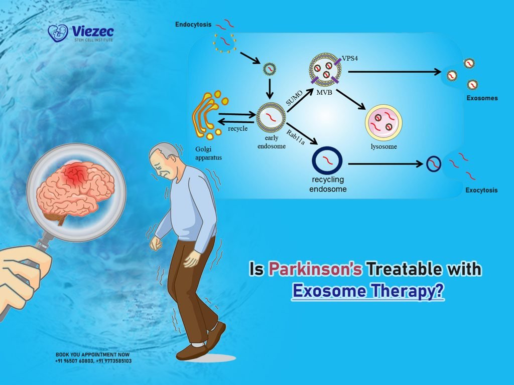 Is Parkinson’s Treatable with Exosome Therapy