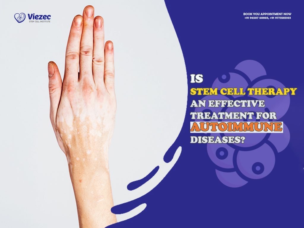 Is Stem Cell Therapy an Effective Treatment for Autoimmune Diseases?