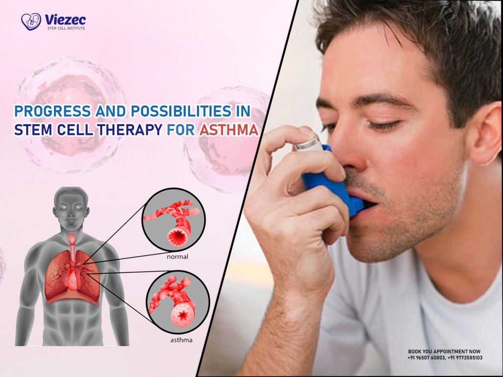 Progress and Possibilities in Stem Cell Therapy for Asthma