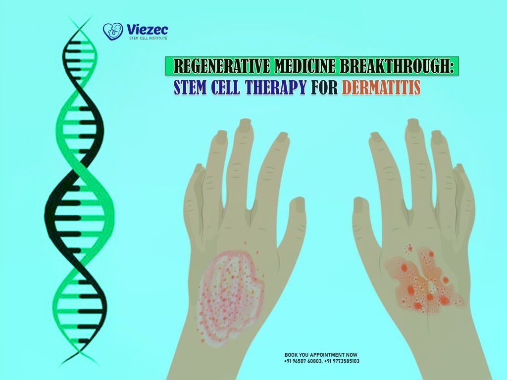 Regenerative Medicine Breakthrough: Stem Cell Therapy for Dermatitis