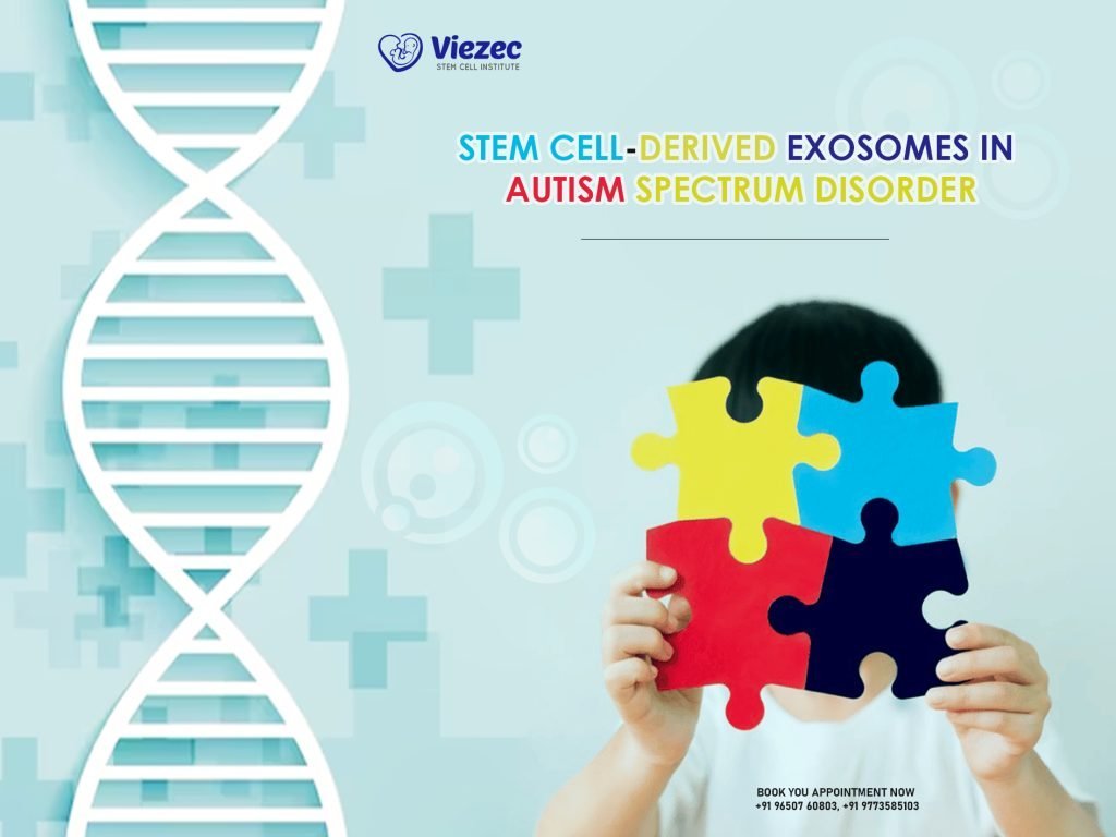Stem Cell-Derived Exosomes in Autism Spectrum Disorder