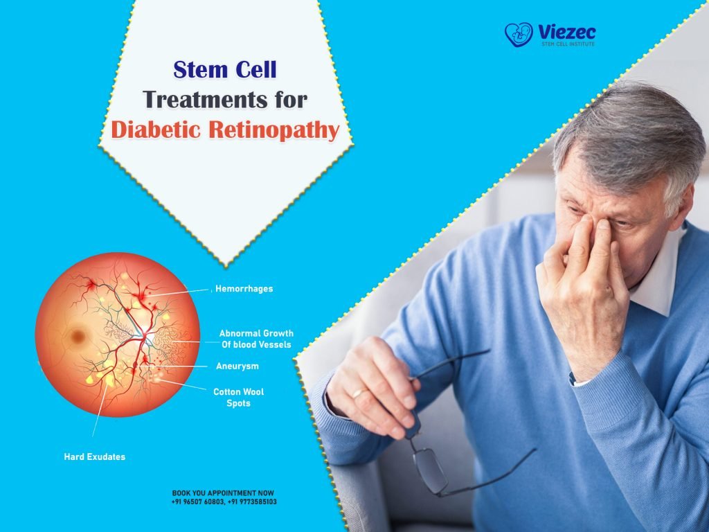 Stem Cell Treatments for Diabetic Retinopathy