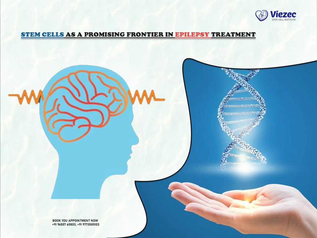 Stem Cells as a Promising Frontier in Epilepsy Treatment