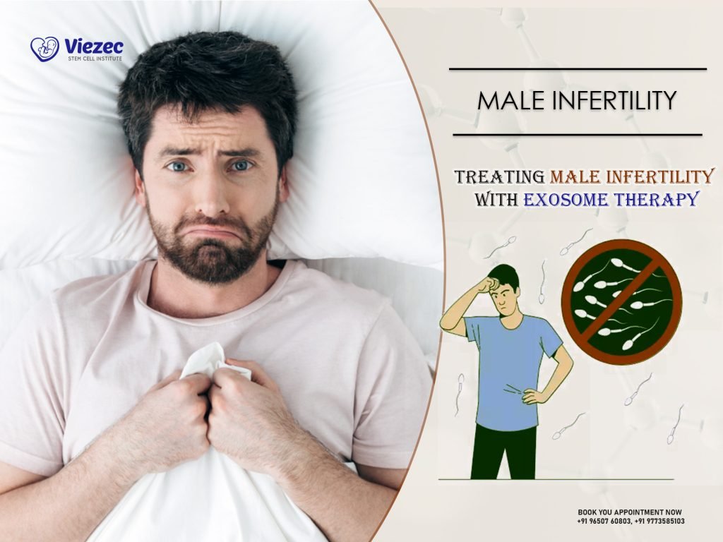 Treating Male Infertility with Exosome Therapy