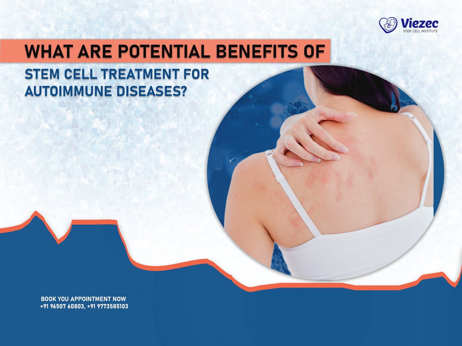 What are Potential Benefits of Stem Cell Treatment for Autoimmune Diseases