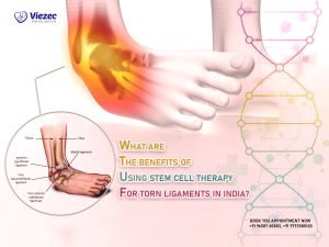 torn ligament