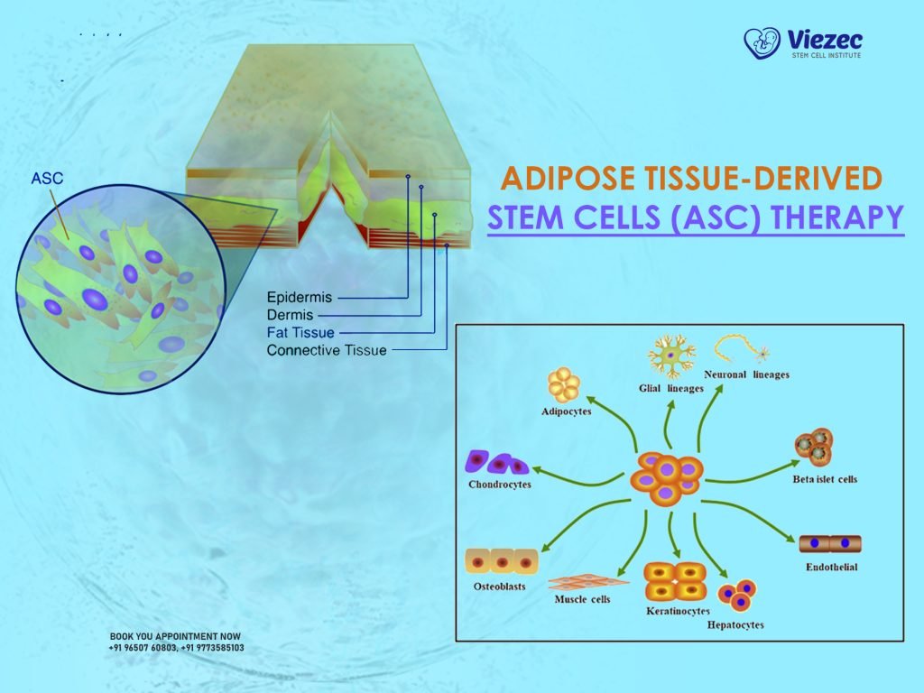 Adipose Tissue-Derived Stem Cells (ASC) Therapy