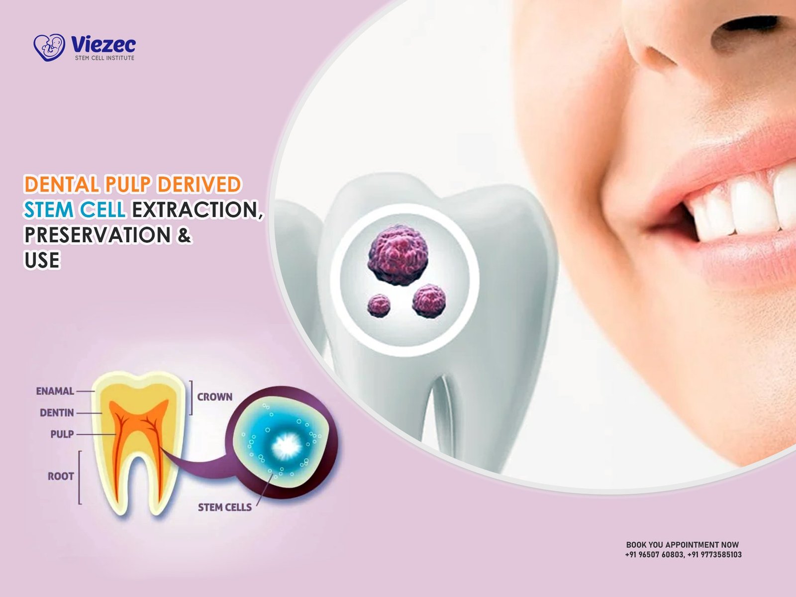 Dental Pulp Derived Stem Cell Extraction, Preservation & Use