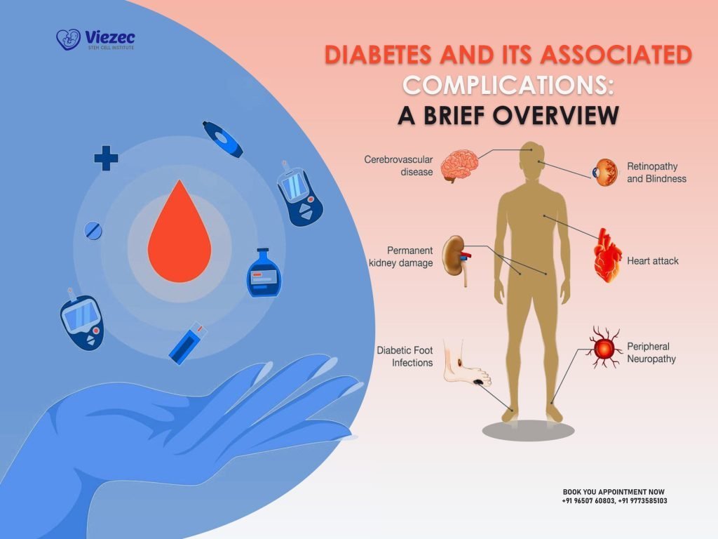 Diabetes and its Associated Complications: A Brief Overview