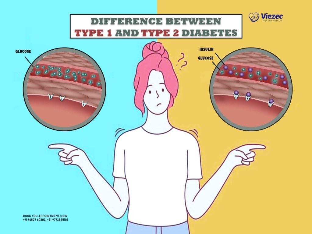 Difference between Type 1 and Type 2 Diabetes