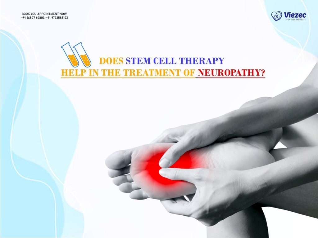 Does Stem Cell Therapy Help in the Treatment of Neuropathy?