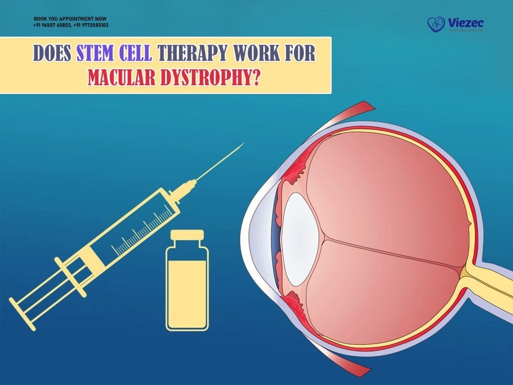 Does Stem Cell Therapy Work for Macular Dystrophy?