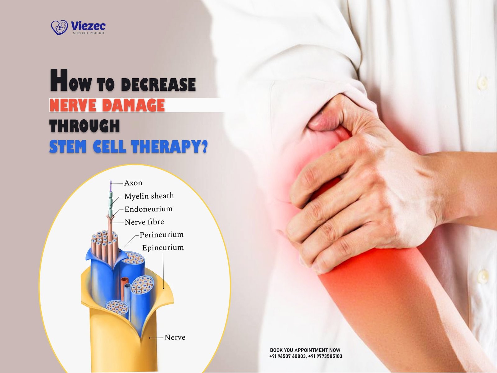 HOW TO DECREASE NERVE DAMAGE THROUGH STEM CELL THERAPY