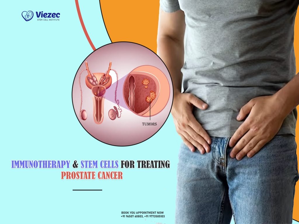 Immunotherapy & Stem Cells for Treating Prostate Cancer