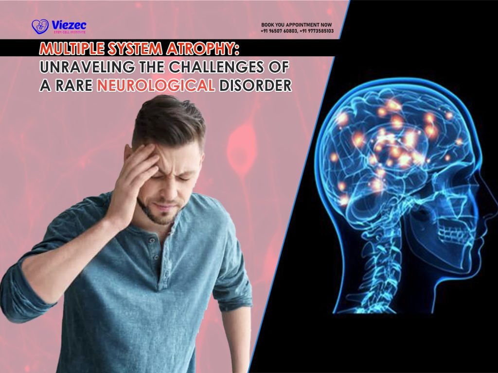 Multiple System Atrophy: Unraveling the Challenges of a Rare Neurological Disorder