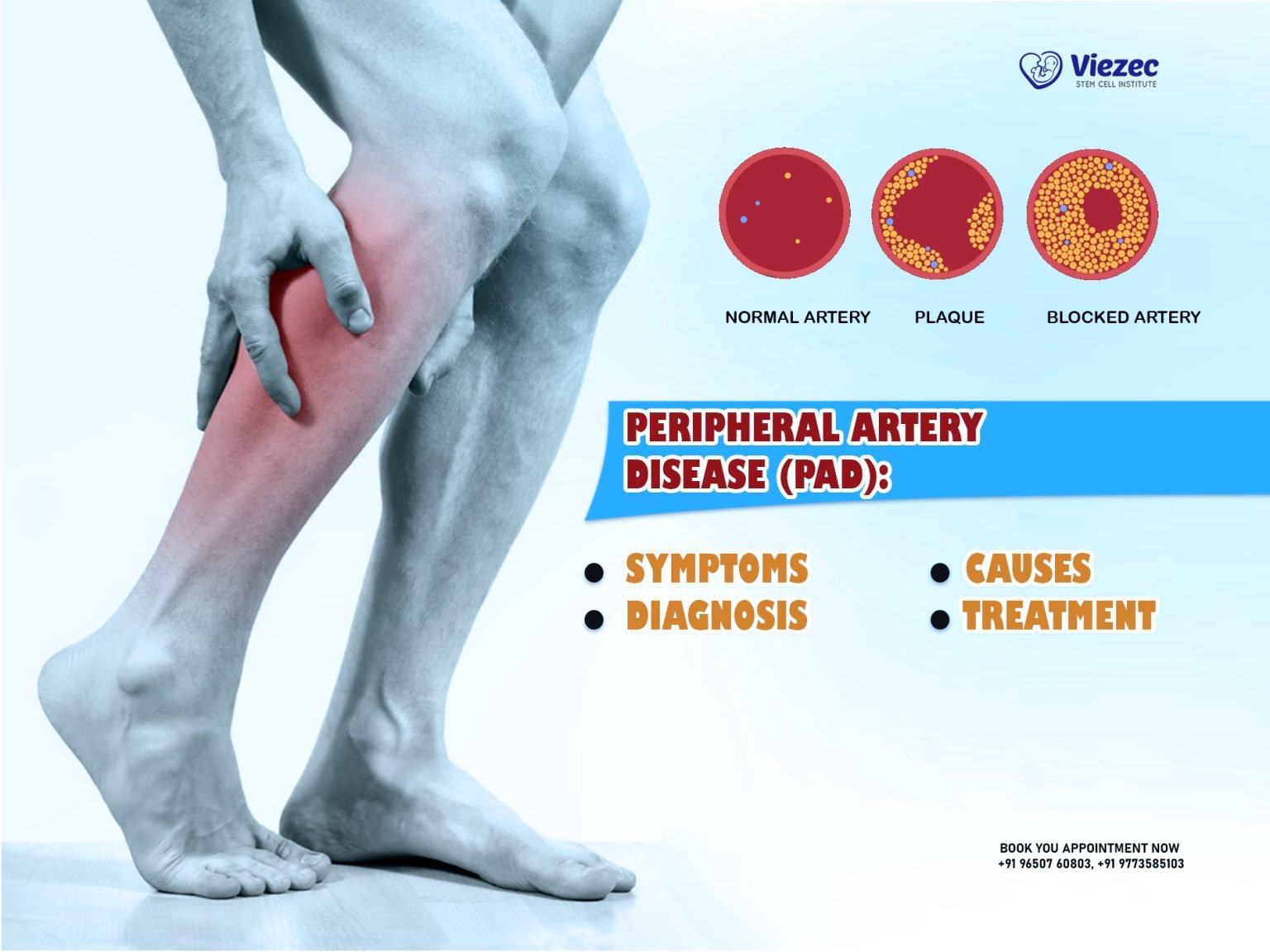 Peripheral Artery Disease Symptoms Causes Diagnosis Treatment how-does-coronary-artery-disease-affect-the-circulatory-system