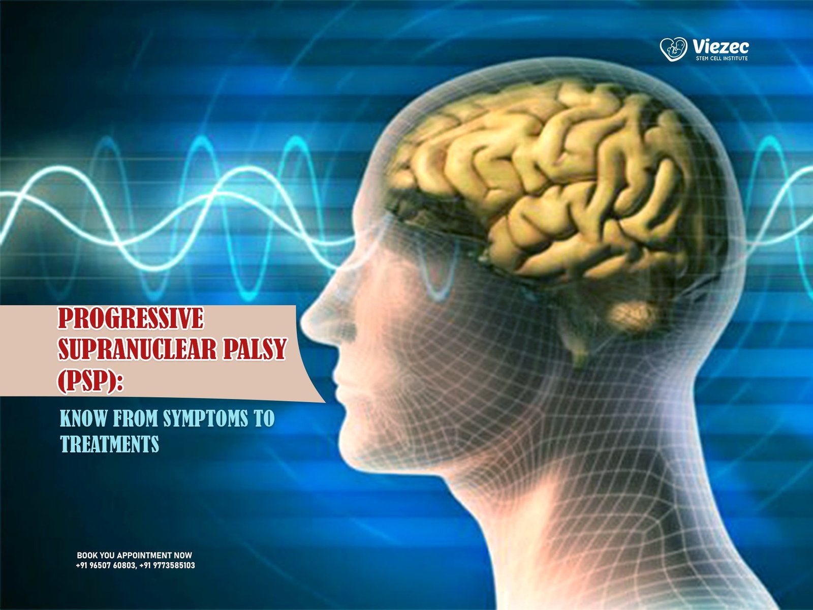 Progressive Supranuclear Palsy (PSP): Know From Symptoms To Treatments