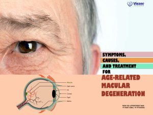 Symptoms, Causes, and Treatment for Age-Related Macular Degeneration