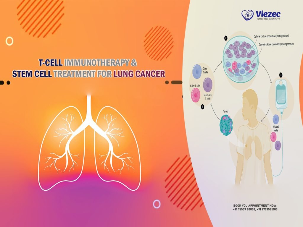T-Cell Immunotherapy & Stem Cell Treatment for Lung Cancer