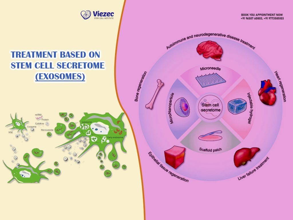 Treatment Based on Stem Cell Secretome (Exosomes)