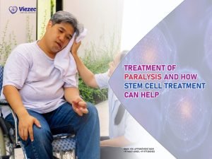 Treatment of Paralysis and How Stem Cell Treatment Can Help