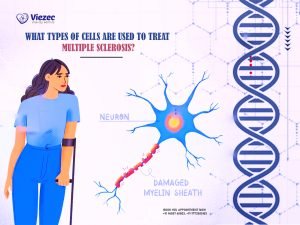 What Types of Cells are Used to Treat Multiple Sclerosis?